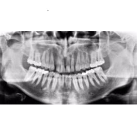 Filmy RTG – stomatologiczne Primax-Berlin GmbH RTG-G, RTG-B