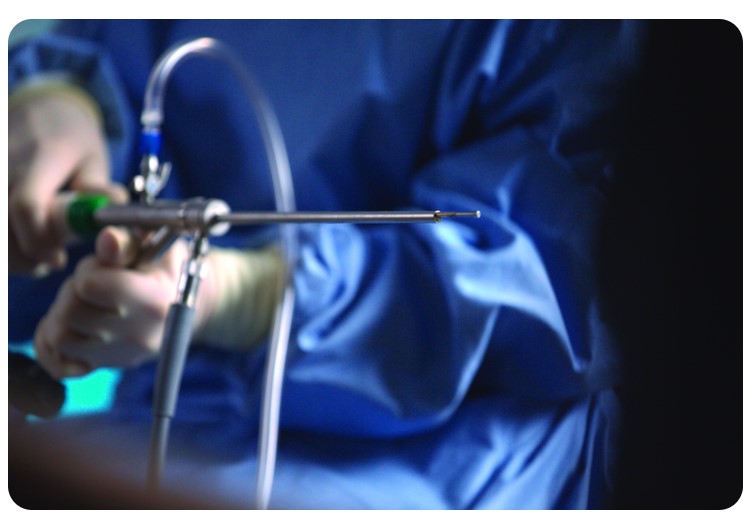 Histeroskopy - optyki histeroskopowe HOLOGIC MyoSure