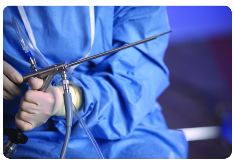 Histeroskopy - optyki histeroskopowe HOLOGIC MyoSure