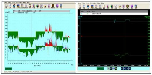 Holtery ciśnieniowe (ABPM) CONTEC ABPM50