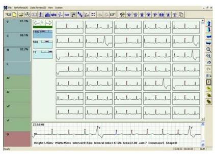 Holtery EKG – rejestratory CONTEC TLC5000