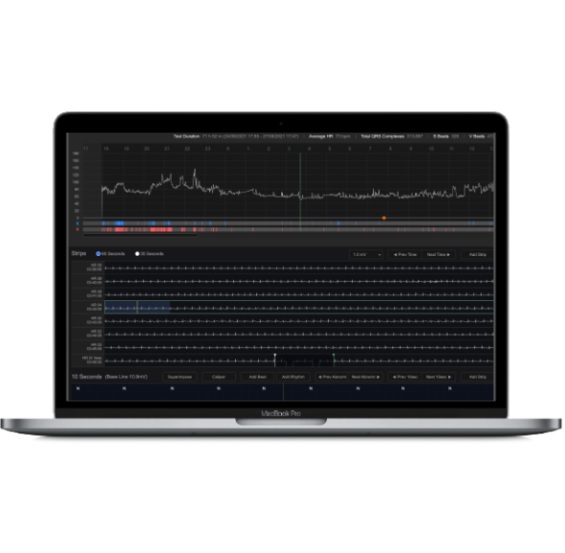 Holtery EKG – rejestratory Wellysis S-Patch EX