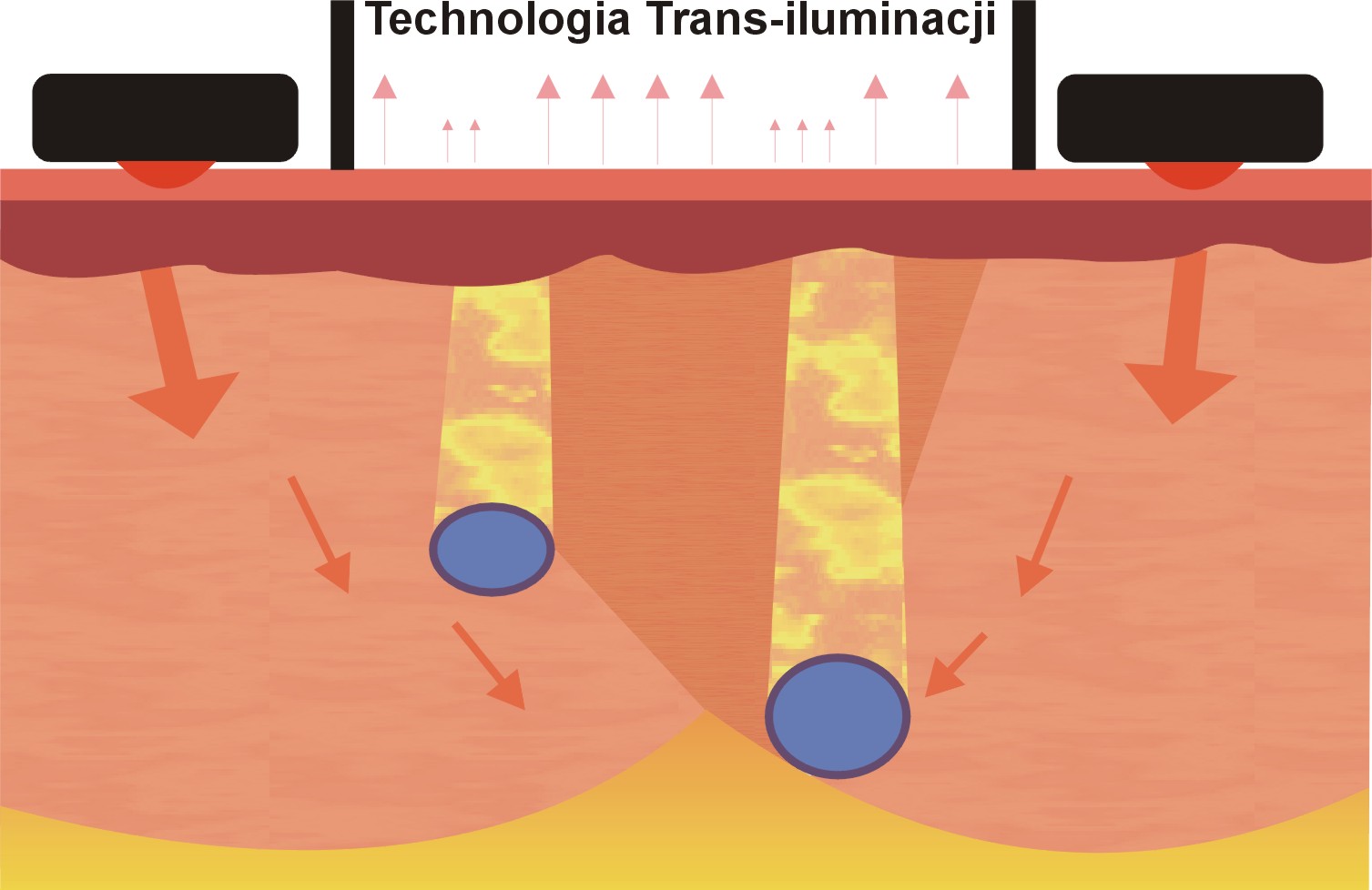 Iluminatory naczyniowe (skanery żył) Novarix IV-eye