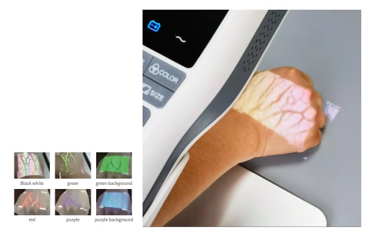 Iluminatory naczyniowe (skanery żył) SIFVein VEIN FINDER 30