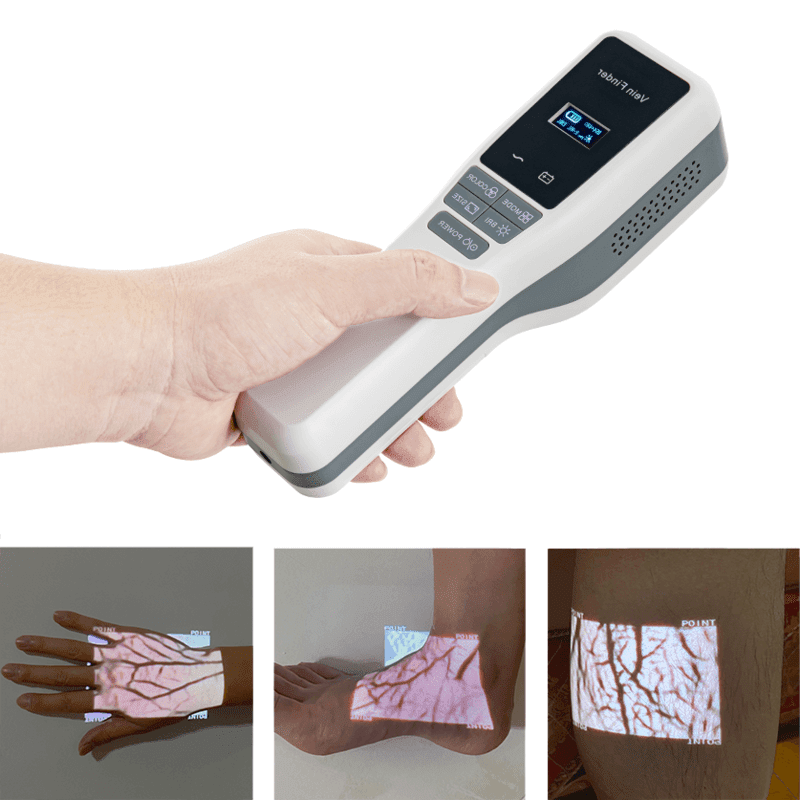 Iluminatory naczyniowe (skanery żył) SIFVein VEIN FINDER 30