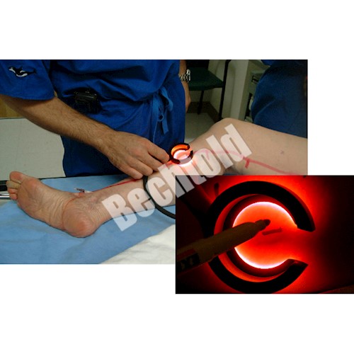 Iluminatory naczyniowe (skanery żył) Veinlite 220