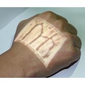 Iluminatory naczyniowe (skanery żył) VIVOLIGHT Medical Device VIVO500