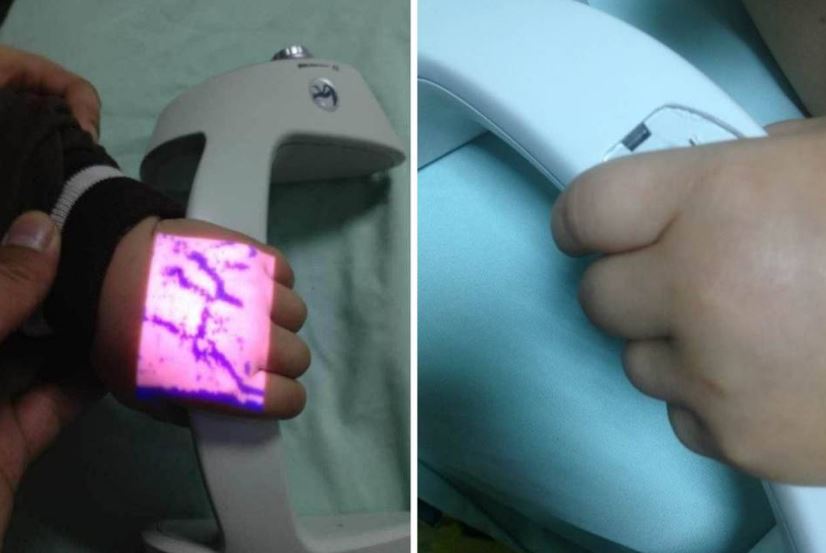 Iluminatory naczyniowe (skanery żył) ZD - Medical Inc. JM-260-01