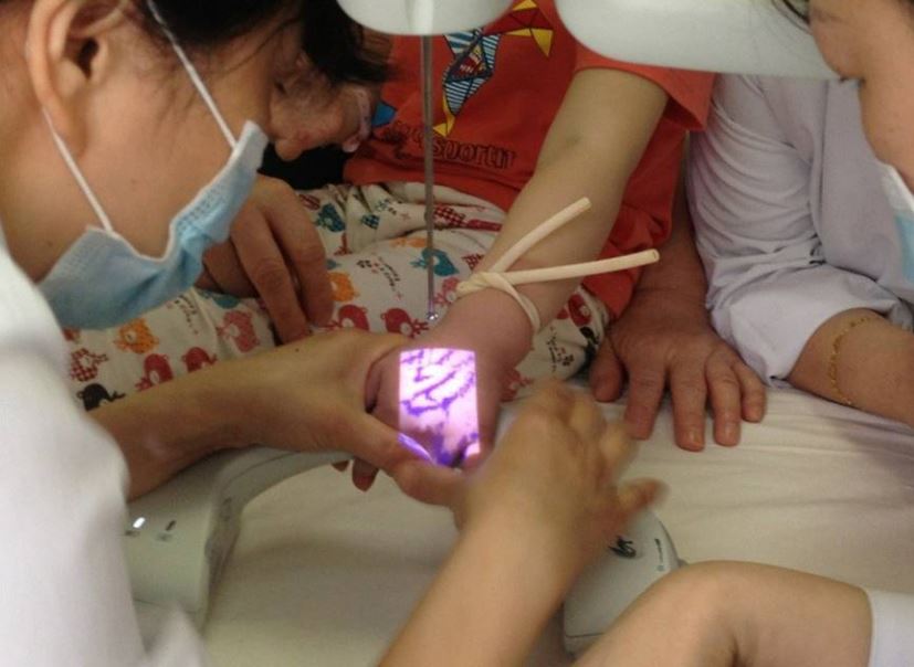 Iluminatory naczyniowe (skanery żył) ZD - Medical Inc. JM-260-04