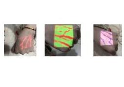 Iluminatory naczyniowe (skanery żył) ZD - Medical Inc. ZD-260-04