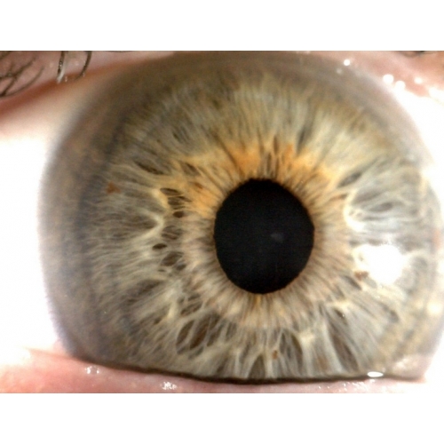 Irydoskopy Dino-Lite MEDL4R