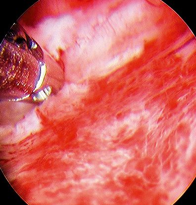 Kamery endoskopowe SOPRO-COMEG SOPRO 367 3CCD