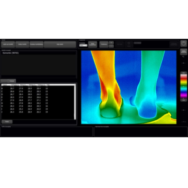 Kamery termowizyjne do pomiaru temperatury ciała osób THERMIDAS IRT-384