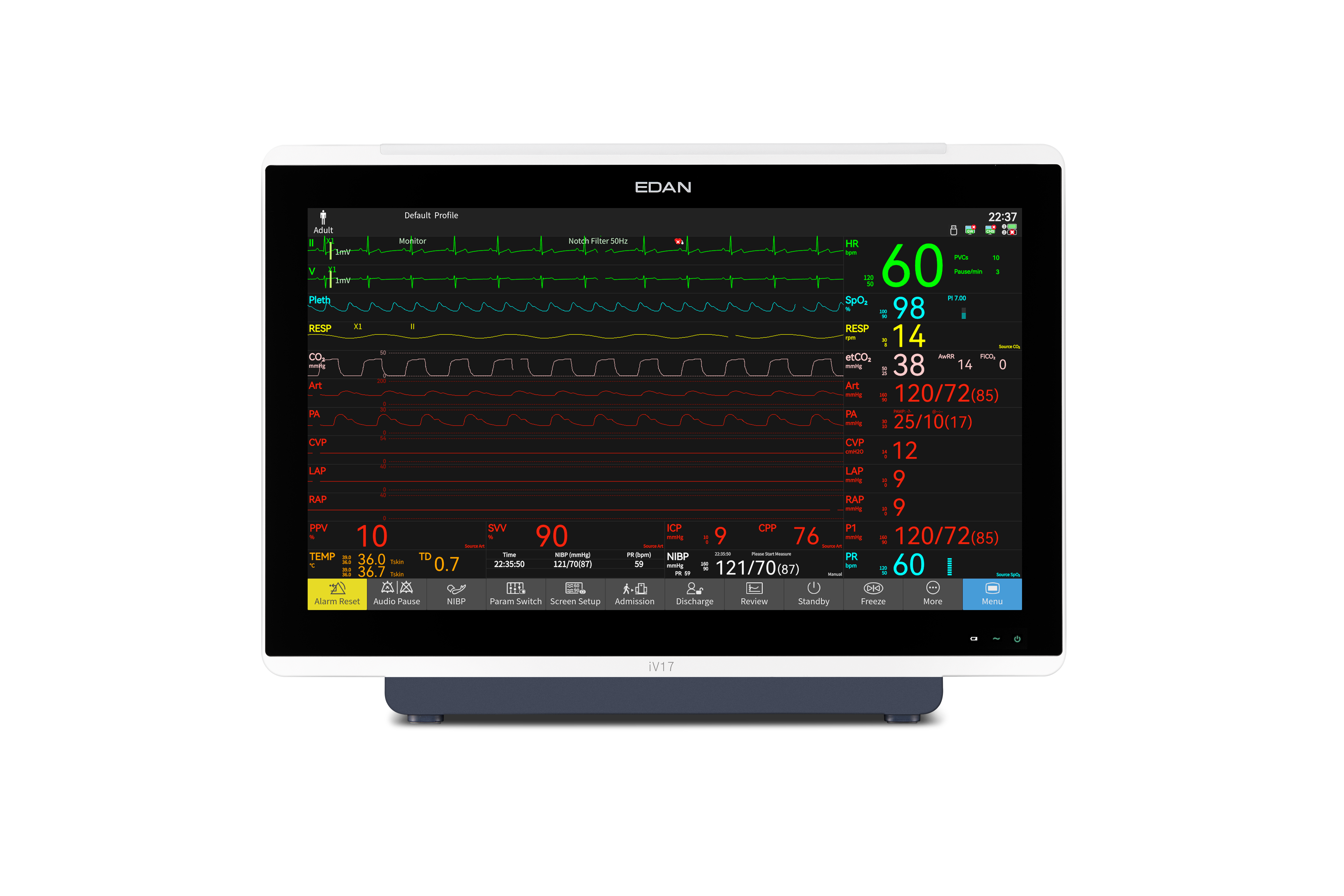 Kardiomonitory przyłóżkowe EDAN iV12 / iV15 / iV17