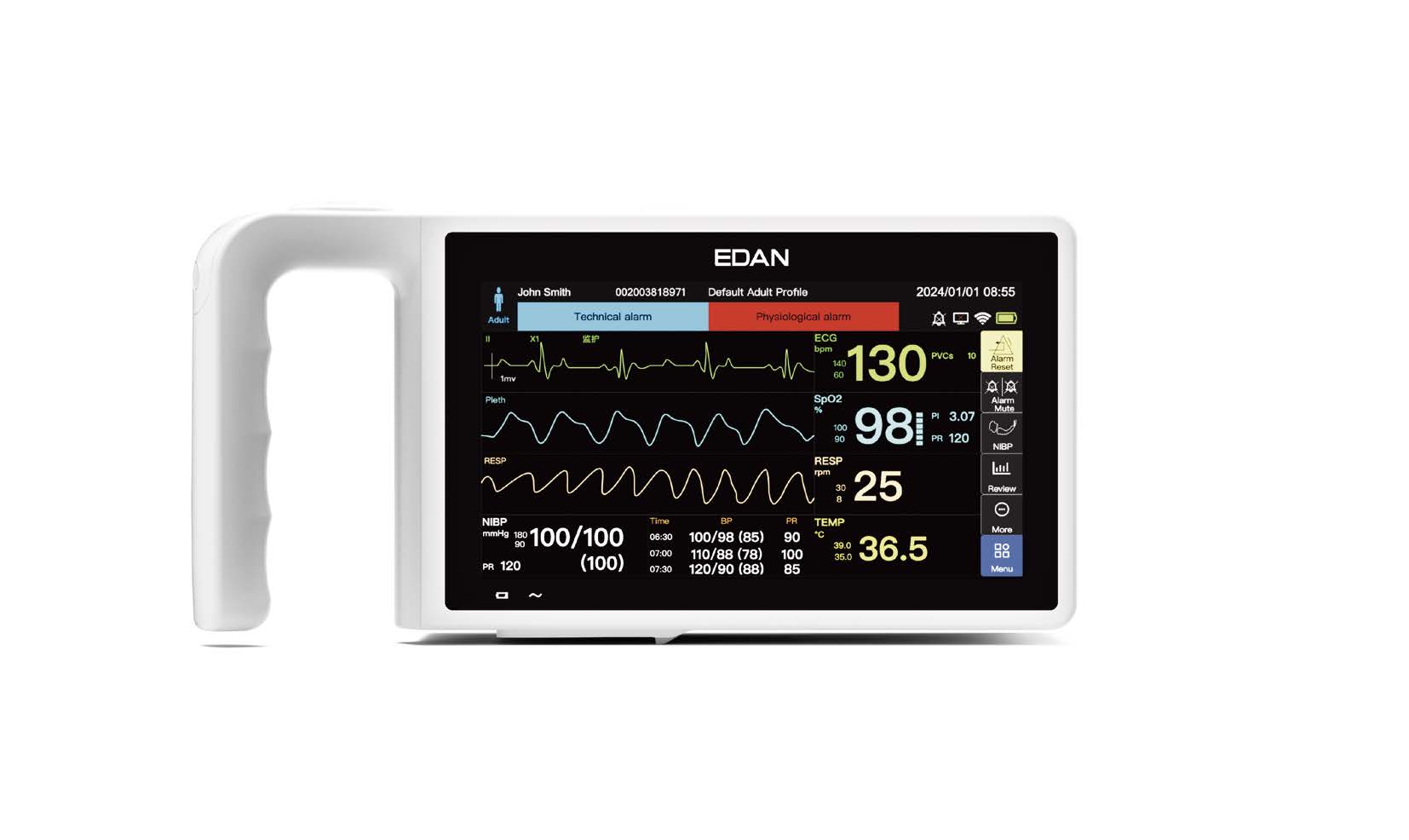 Kardiomonitory przyłóżkowe EDAN iV12 / iV15 / iV17
