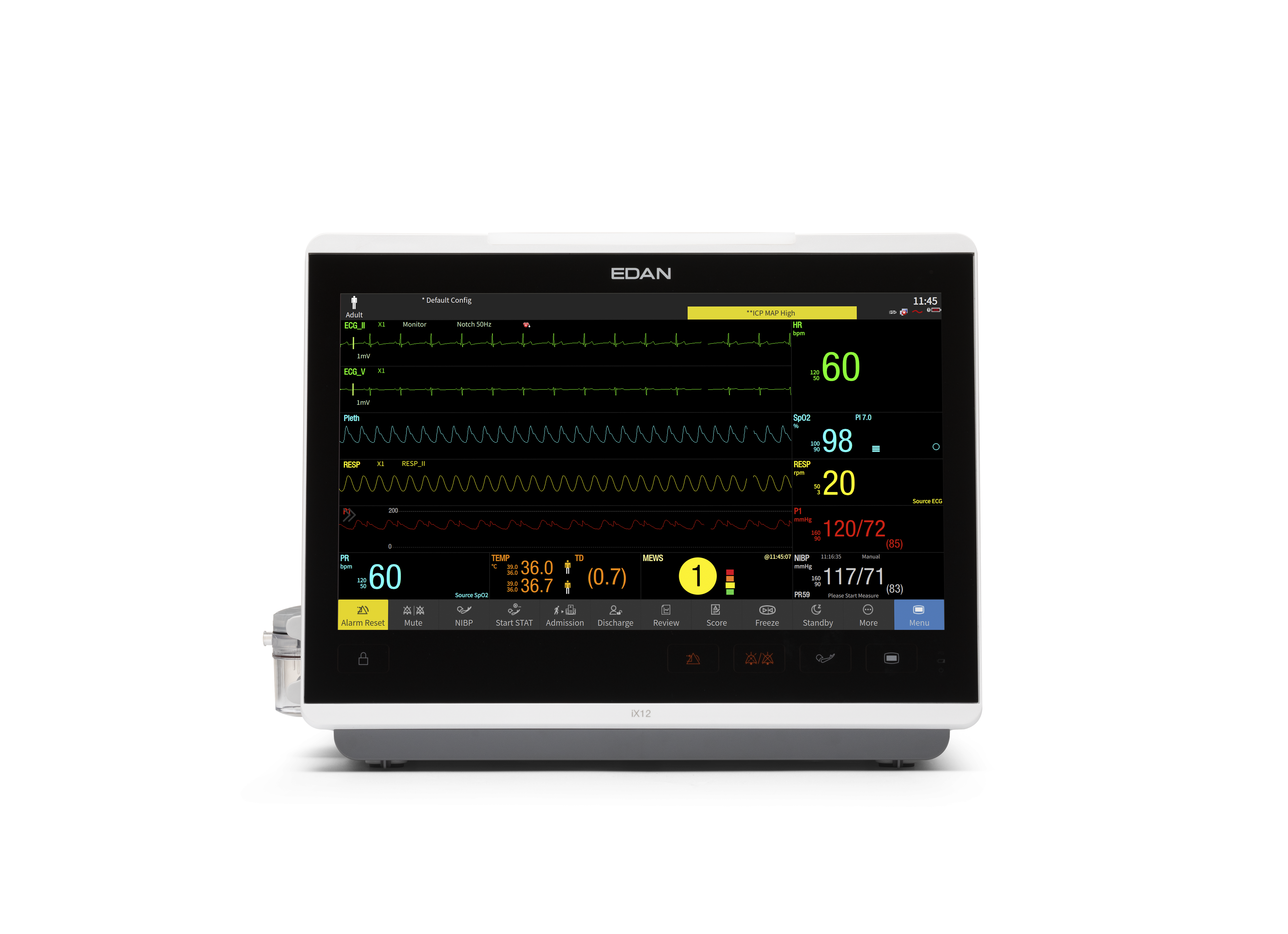 Kardiomonitory przyłóżkowe EDAN iX10 / iX12 / iX15