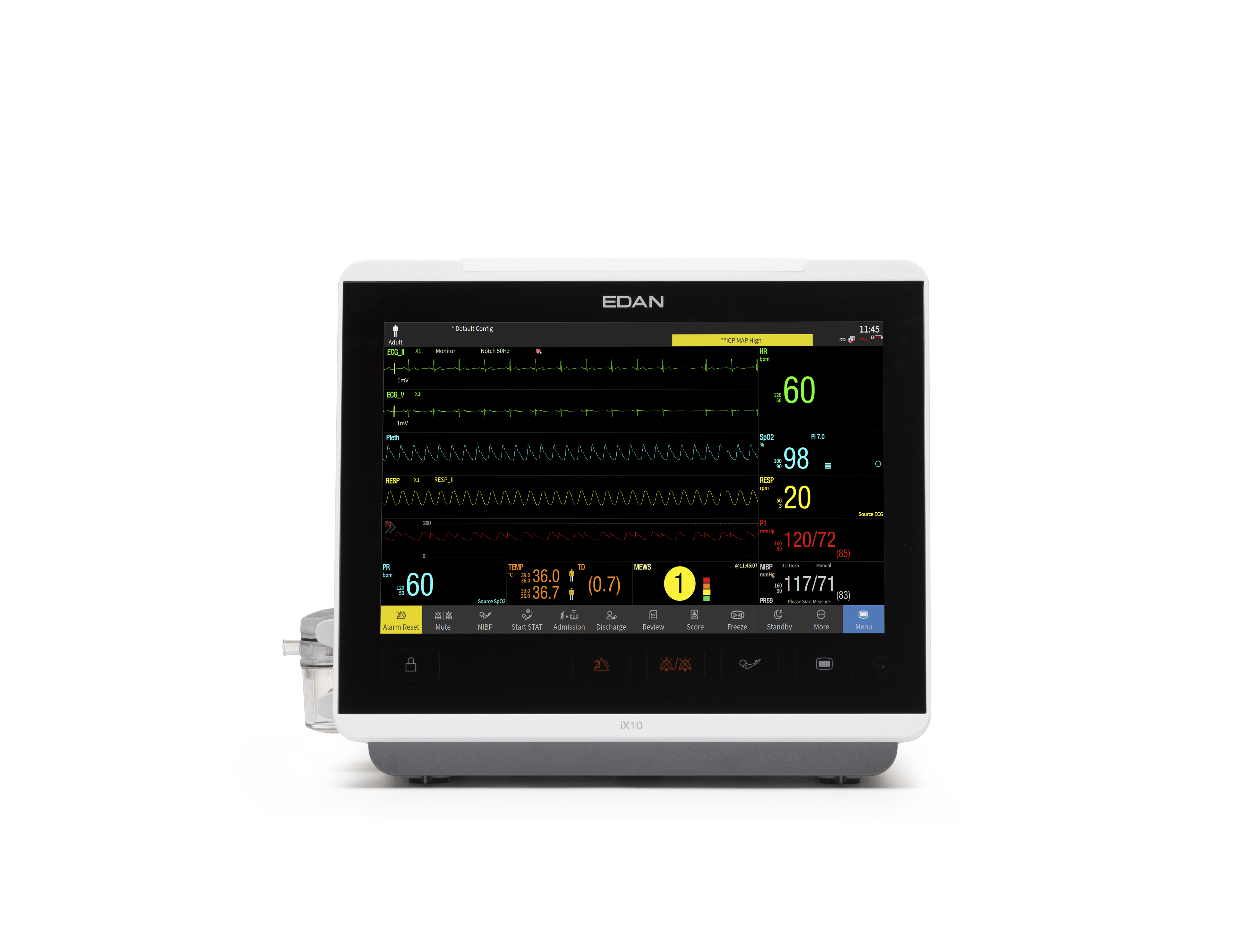 Kardiomonitory przyłóżkowe EDAN iX10 / iX12 / iX15