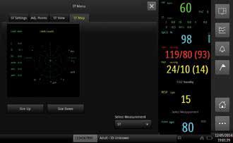 Kardiomonitory przyłóżkowe PHILIPS Efficia CM100/ CM120/ CM150