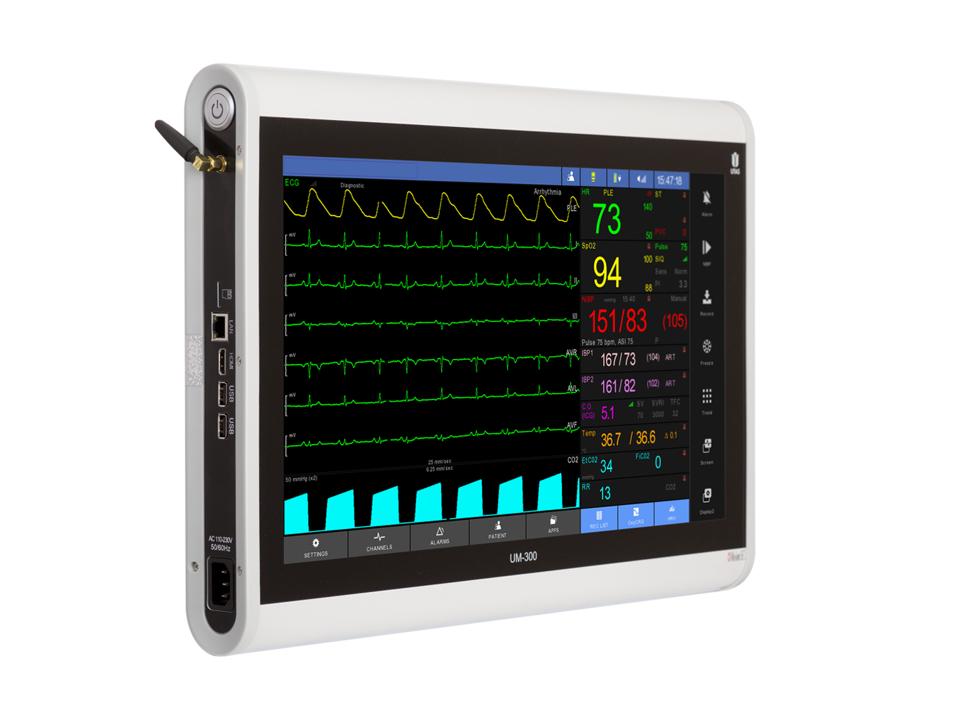 Kardiomonitory przyłóżkowe UTAS UM 300-S