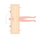 Koce i mankiety do aparatów do ogrzewania - ochładzania pacjenta Cocoon CLM