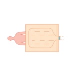 Koce i mankiety do aparatów do ogrzewania - ochładzania pacjenta Cocoon CLM