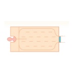 Koce i mankiety do aparatów do ogrzewania - ochładzania pacjenta Cocoon CLM