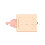 Koce i mankiety do aparatów do ogrzewania - ochładzania pacjenta Cocoon CLM