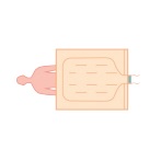 Koce i mankiety do aparatów do ogrzewania - ochładzania pacjenta Cocoon CLM