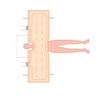 Koce i mankiety do aparatów do ogrzewania - ochładzania pacjenta Cocoon CLM