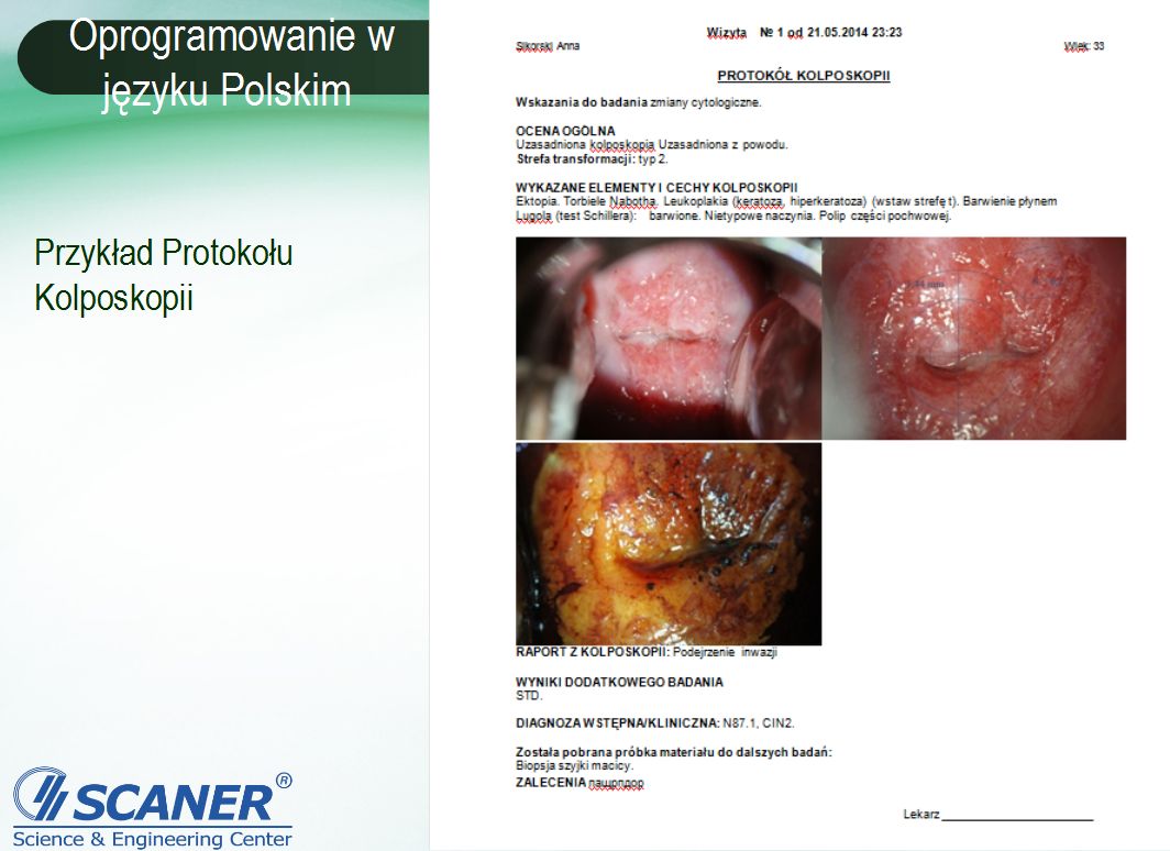 Kolposkopy Scaner MK-300