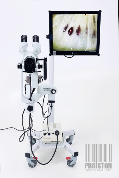 Kolposkopy używane B/D Olympus OCS-500 - Praiston rekondycjonowany
