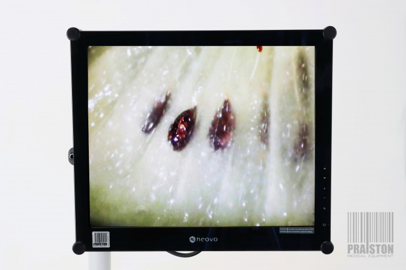 Kolposkopy używane B/D Olympus OCS-500 - Praiston rekondycjonowany