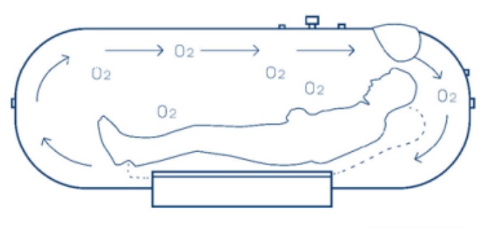 Komory hiperbaryczne HiCare HP1501-75 / HP1501-90