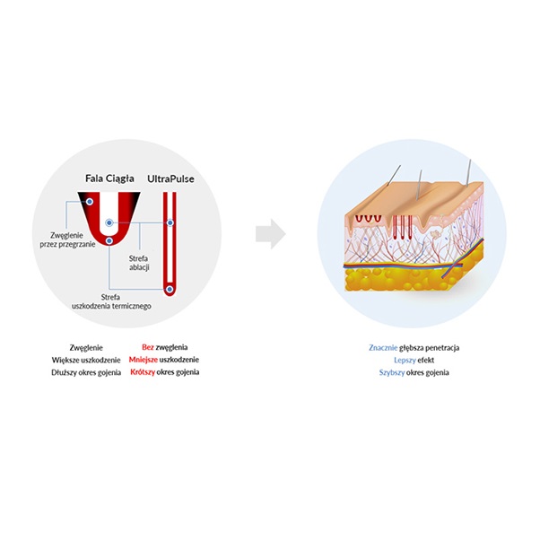 Lasery dermatologiczne Finexel Finexel
