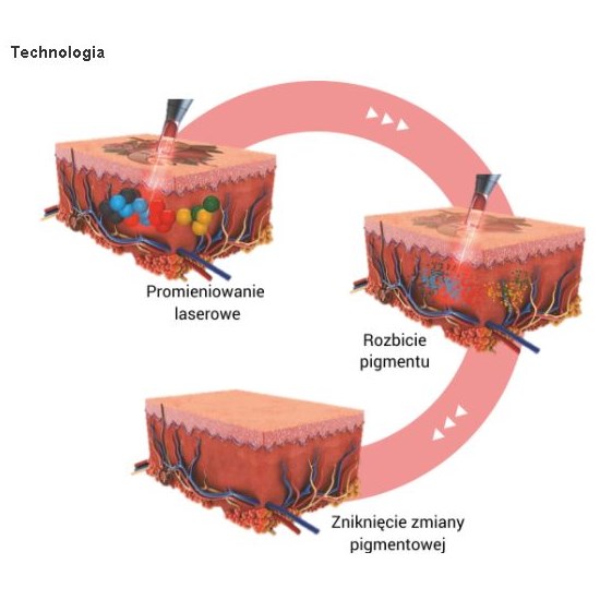 Lasery dermatologiczne Wontech PICOcare