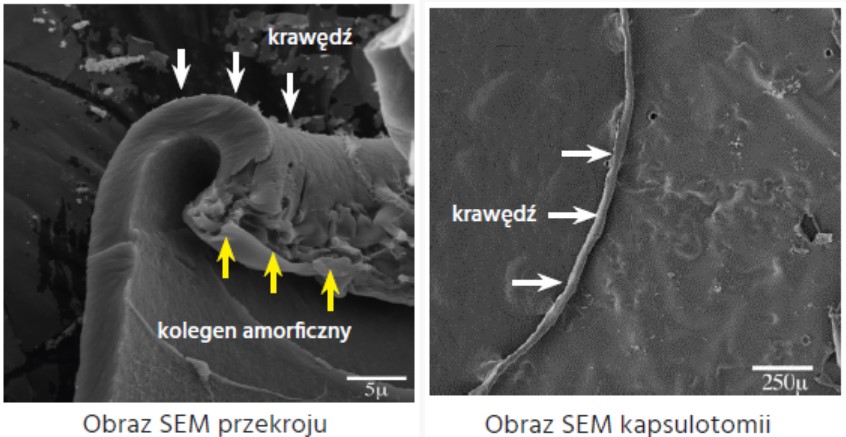 Lasery okulistyczne EXCEL-LENS CAPSULaser