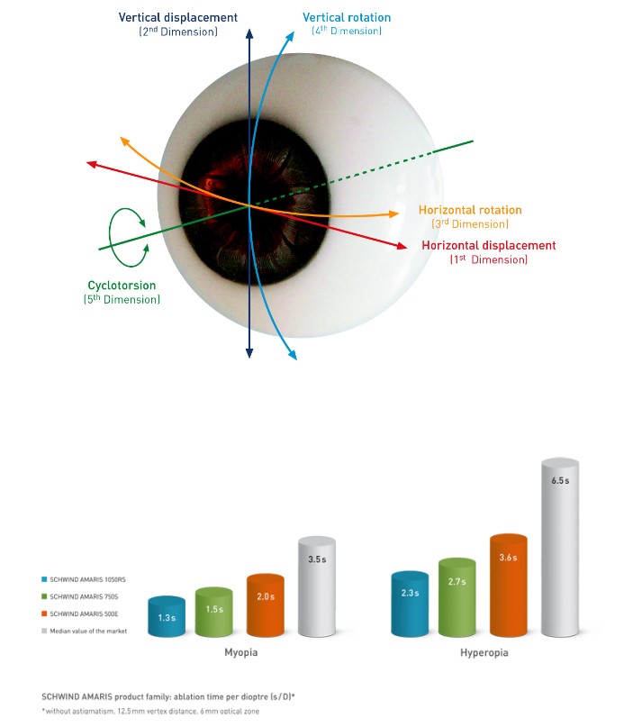 Lasery okulistyczne - Systemy SCHWIND AMARIS® 500E