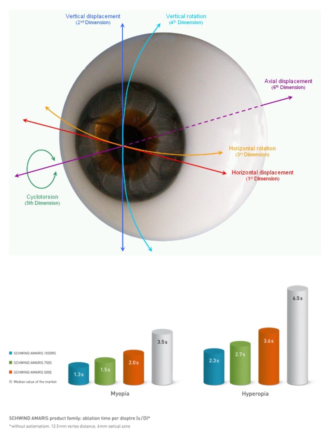 Lasery okulistyczne - Systemy SCHWIND AMARIS® 750S