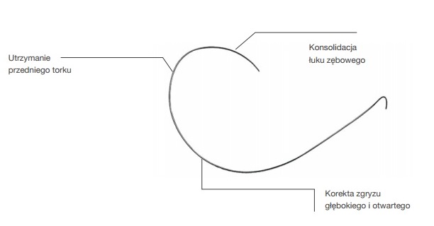Łuki ortodontyczne Trachem Łuki niklowo-tytanowe termiczne z krzywą SPEE