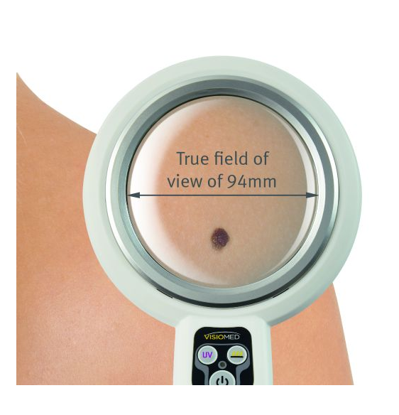 Lupy zabiegowe Visiomed OPTIMA UV