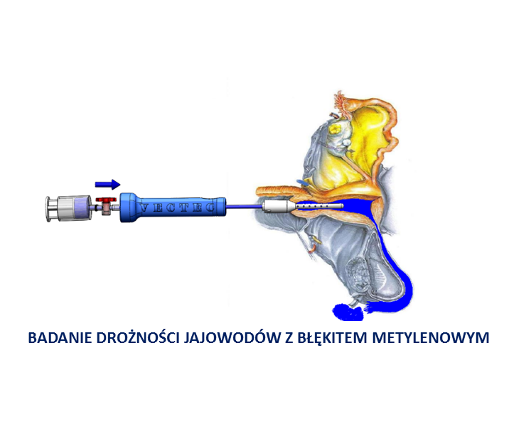 Manipulatory macicy do endoskopów sztywnych Peters Surgical CAUT60