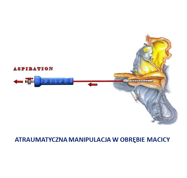 Manipulatory macicy do endoskopów sztywnych Peters Surgical CAUT60