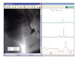 Manometry przewodu pokarmowego MMS Medical Measurement Systems Solar GI