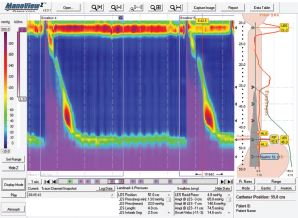 Manometry wysokiej rozdzielczości przewodu pokarmowego Given Imaging ManoScan ESO-Z