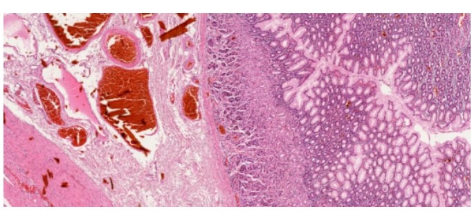 Mikroskopy biologiczne precipoint iO:M8