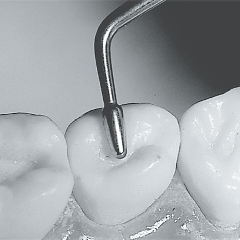 Modelarzyki stomatologiczne LM-Instruments Modelarzyk IO