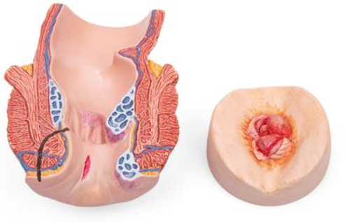 Modele zabiegowe 3B Scientific P16