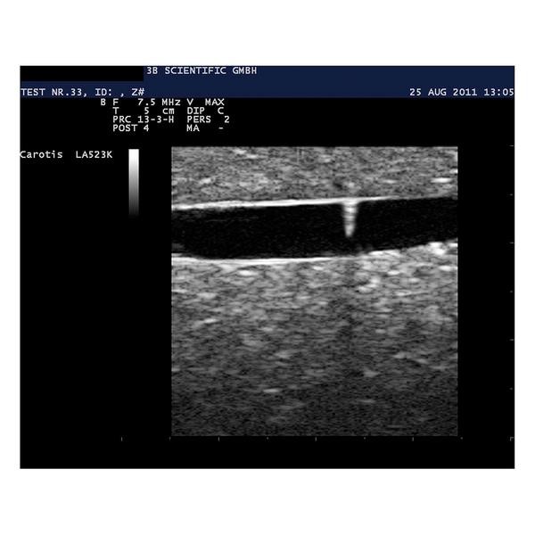 Modele zabiegowe 3B Scientific P60