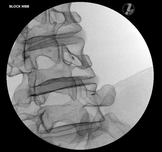 Modele zabiegowe 3B Scientific P65