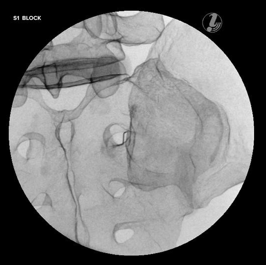 Modele zabiegowe 3B Scientific P65